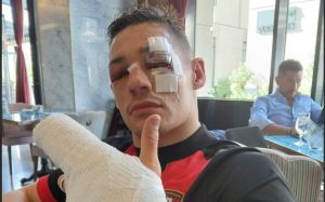 Крис Биллам-Смит: "После поражения размер гонорара за бой упал колоссально"