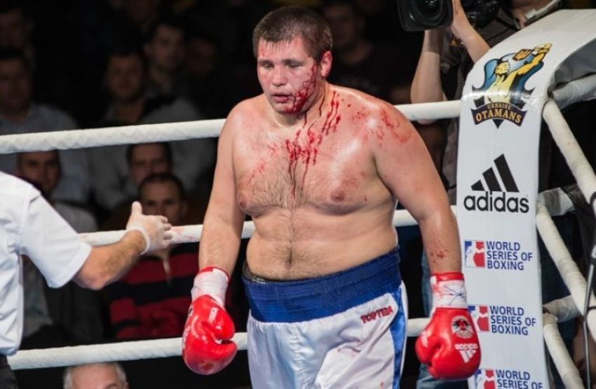Выигрывавший у Фьюри боксер считает, что в России нет профессионального бокса