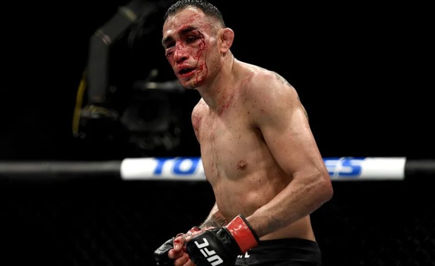 Экс-боец UFC: "Я чувствую, что Гэтжи сломал к чертям Фергюсона"