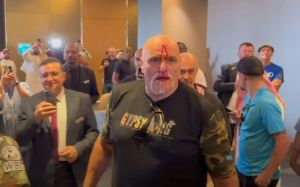 Отцу Тайсона Фьюри разбили лоб во время потасовки с командой Усика: видео