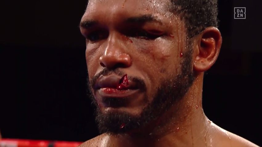 Хайме Мунгия vs Туреано Джонсон: ранение губы и остановка боя