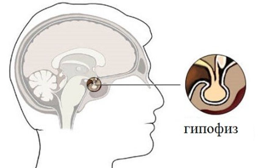 Запрет ТЗТ. Всё ли так однозначно?