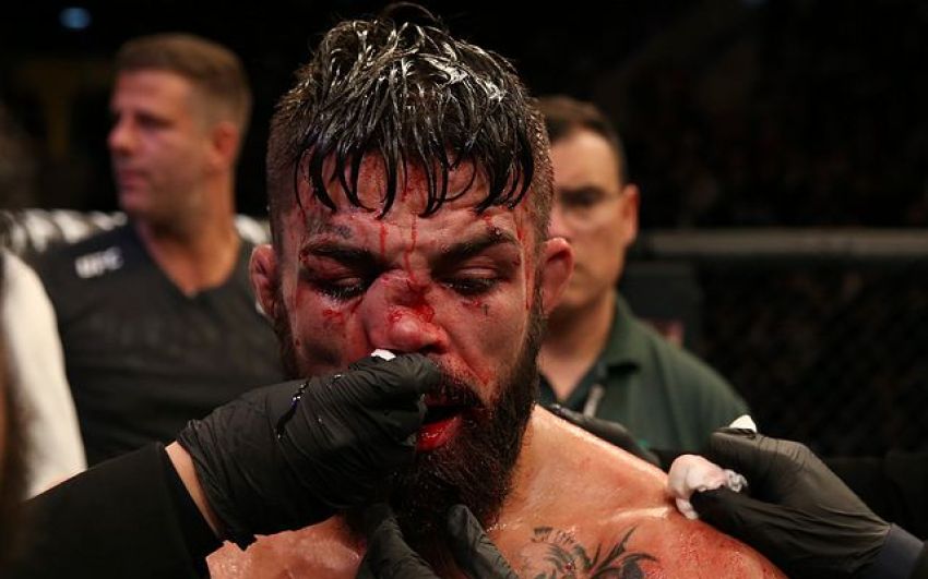 Медицинские отстранения участников турнира UFC Fight Night 156: Валентина Шевченко - Лиз Кармуш 2