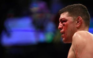 Официальное реакция UFC на арест Ника Диаса за домашнее насилие