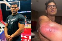 Пауло Коста поделился подробностями травмы, которую он получил перед боем с Хамзатом Чимаевым
