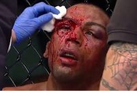 Медицинские отстранения после турнира UFC Fight Night 128