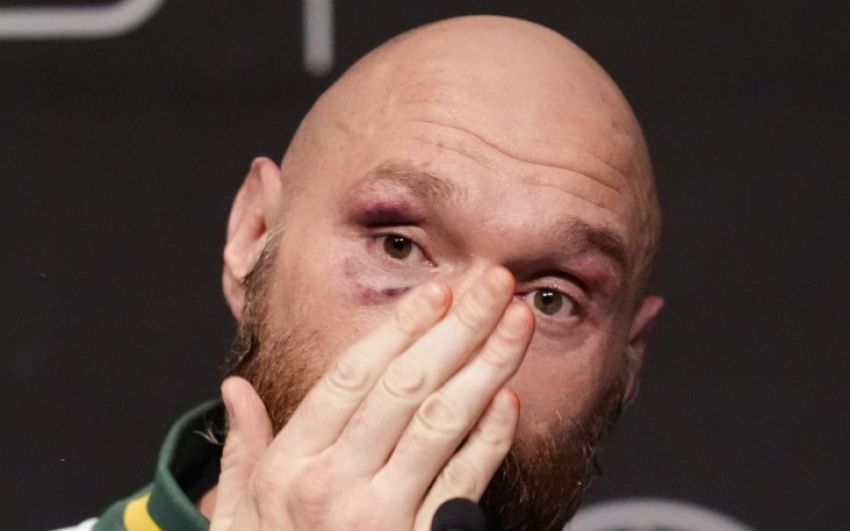 Владимир Хрюнов: "Мы увидим бой Тайсона Фьюри и Федора Емельяненко в "Лужниках"