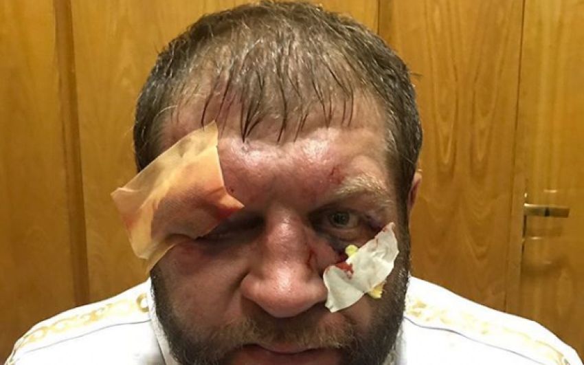 Александр Емельяненко прокомментировал тяжелейший бой с Тони Джонсоном