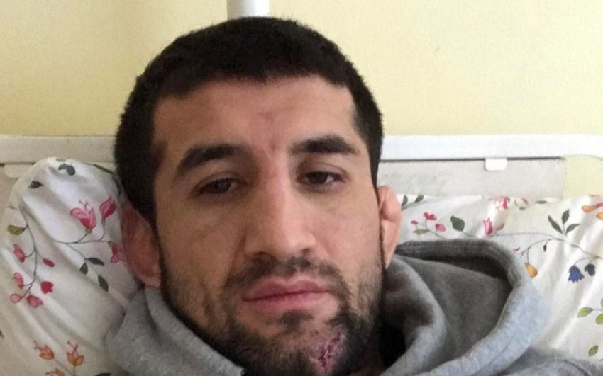 Расул Мирзаев: Удивляет, что напавших на меня людей так долго ищут