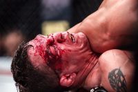 Медицинские отстранения по итогам UFC 209