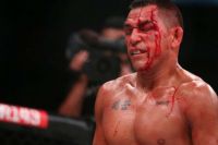 Эммануэль Санчес снялся с Bellator 166