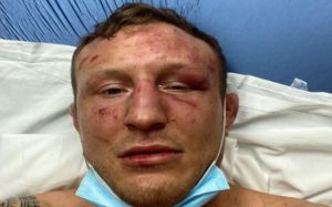 Джек Херманссон сообщил о многочисленных повреждениях после боя с Марвином Веттори