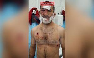 Подробности покушения на Расула Мирзаева: бойца выслеживали 10 дней